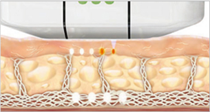 コラーゲン生成開始