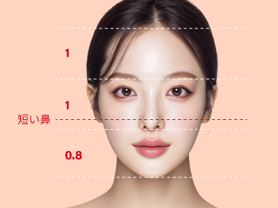 アップノーズの角度診断