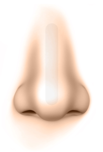 プロテーゼのズレ