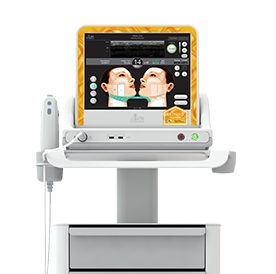 ウルセラ機器 DeepSee技術