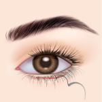 たるみ除去とリフトアップ