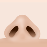 鼻骨幅縮小完了