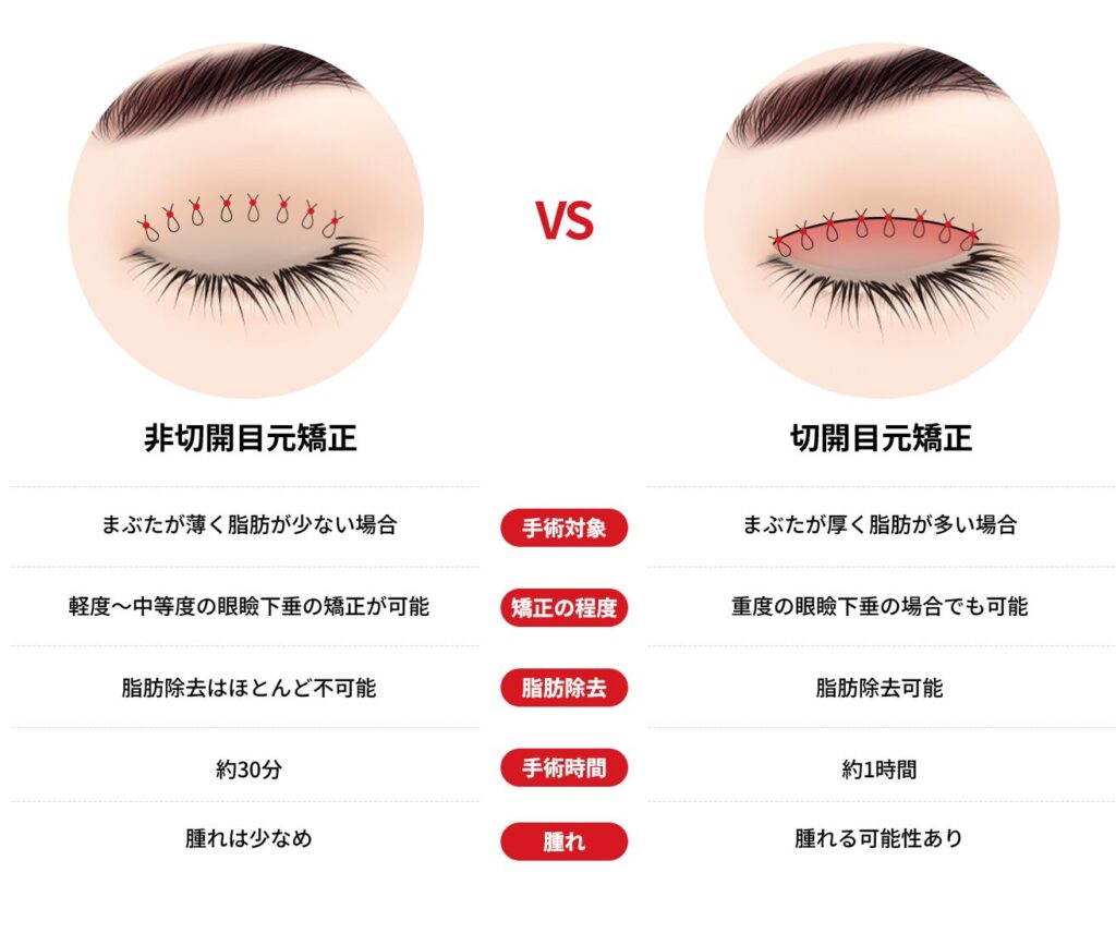 非切開と切開目元矯正の比較