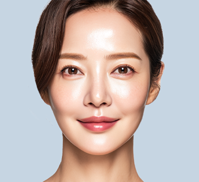 ミニリフト適用部位