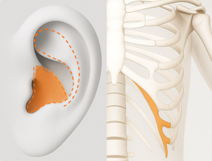 副作用リスクの軽減