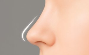 鼻先の支えとライン維持