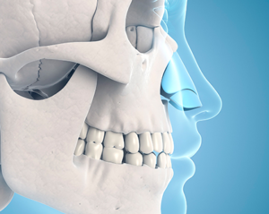 オーダーメイドプロテーゼ製作