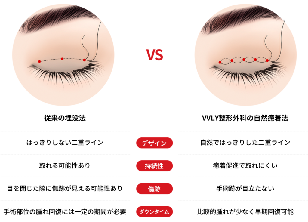 埋没法と自然癒着法の比較
