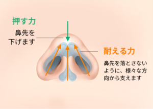 自然な鼻整形のデザイン解説